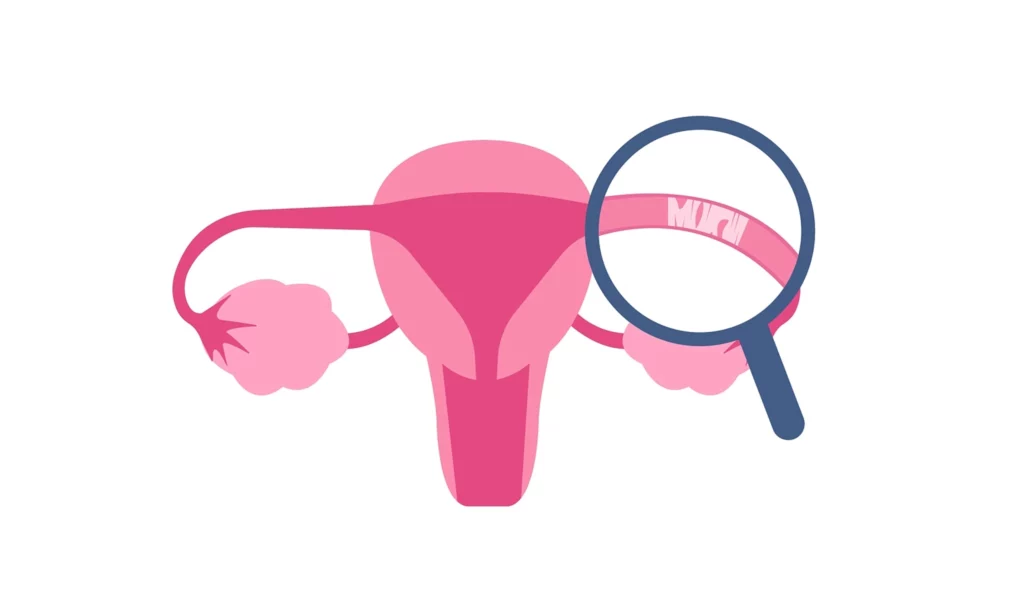 Fallopian Tube Blockage Treatment